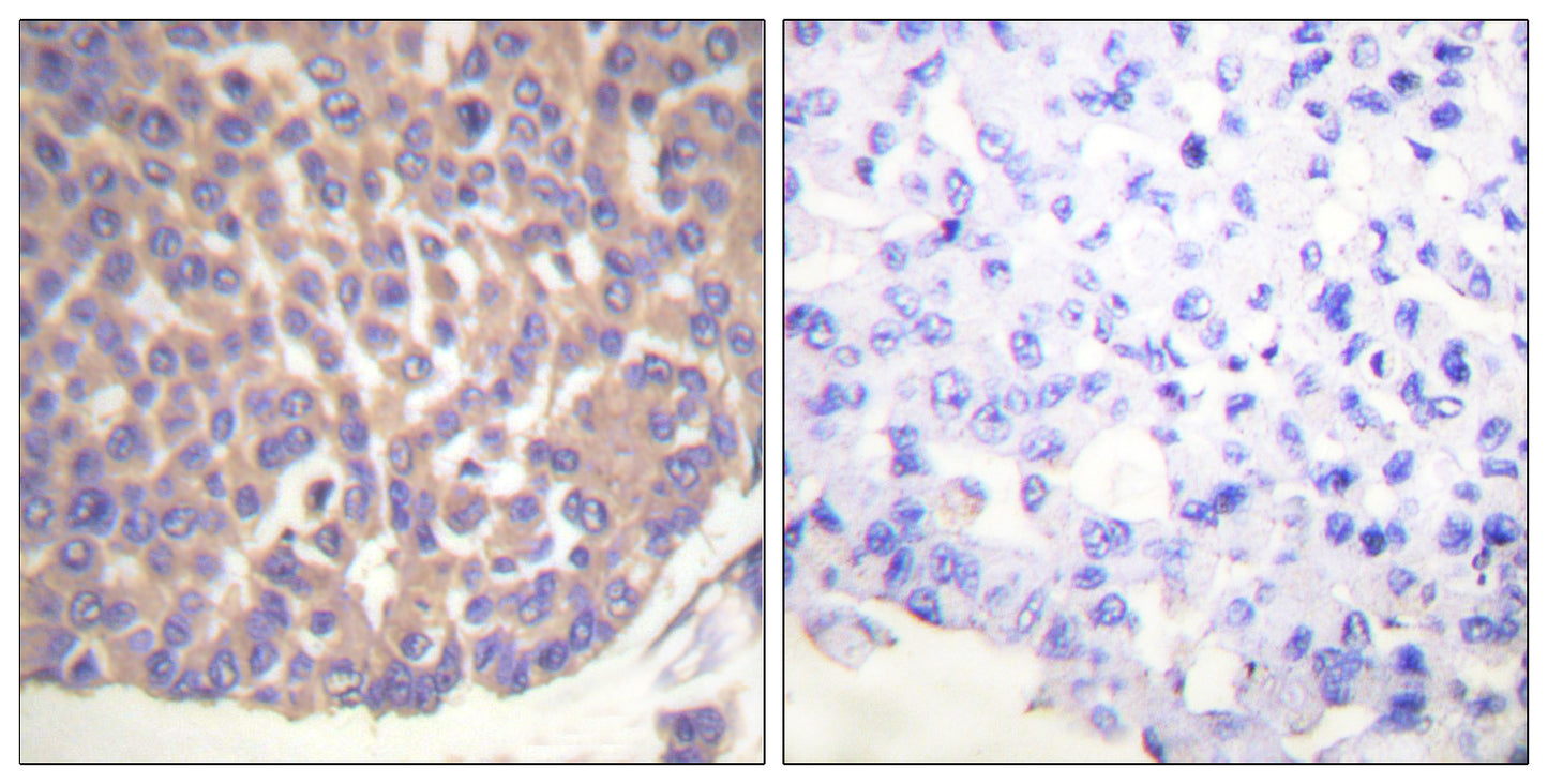Filamin 1 Rabbit Polyclonal Antibody
