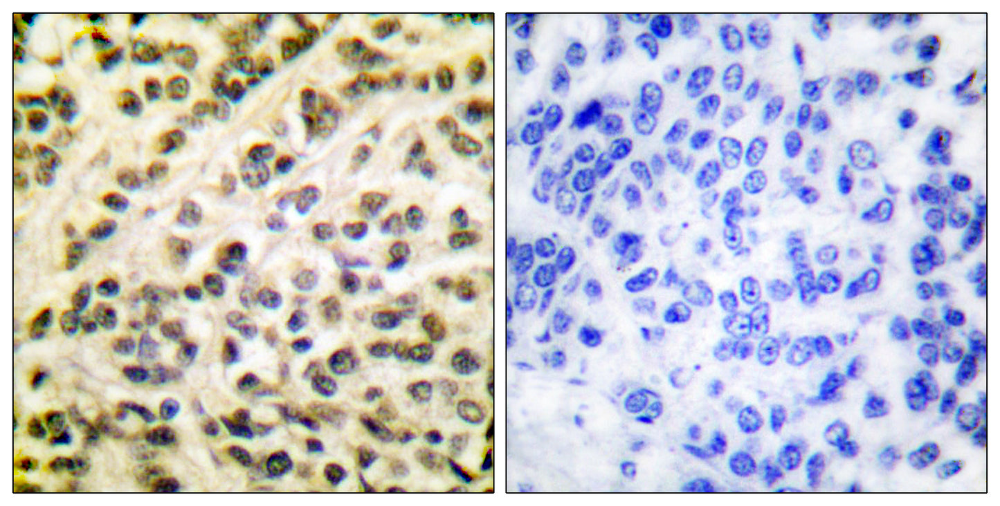 Fli-1 Rabbit Polyclonal Antibody