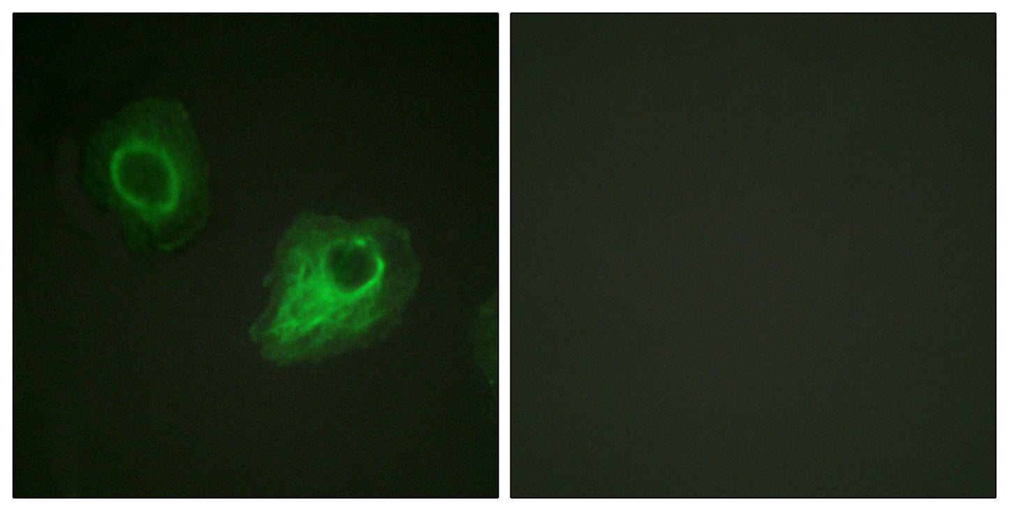 Flk-1/Flt-4 Rabbit Polyclonal Antibody