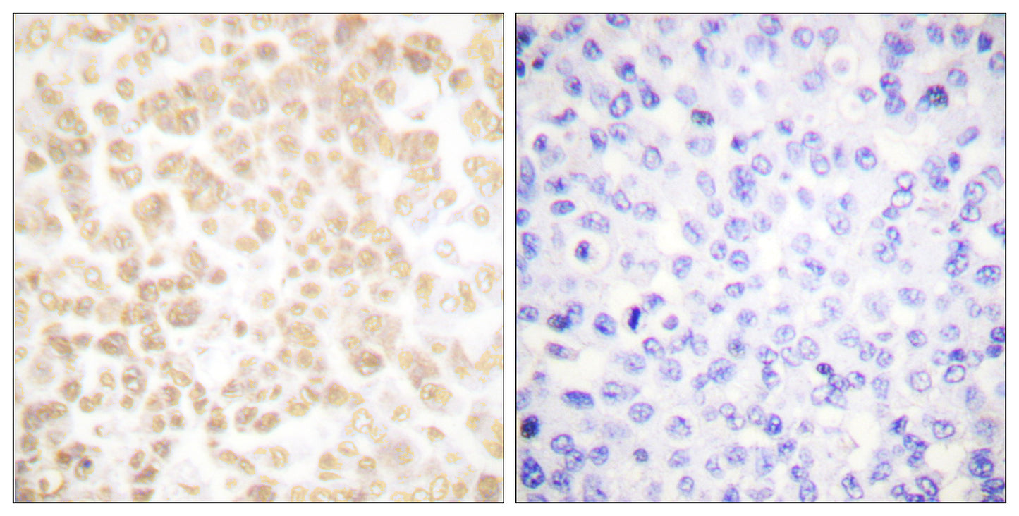 FOSL2 Rabbit Polyclonal Antibody
