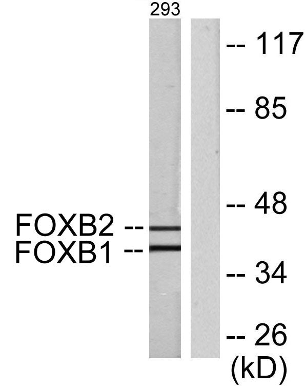FoxB1/2 Rabbit Polyclonal Antibody