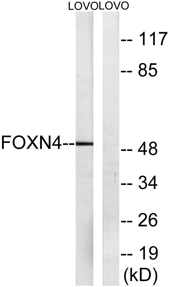 FoxN4 Rabbit Polyclonal Antibody
