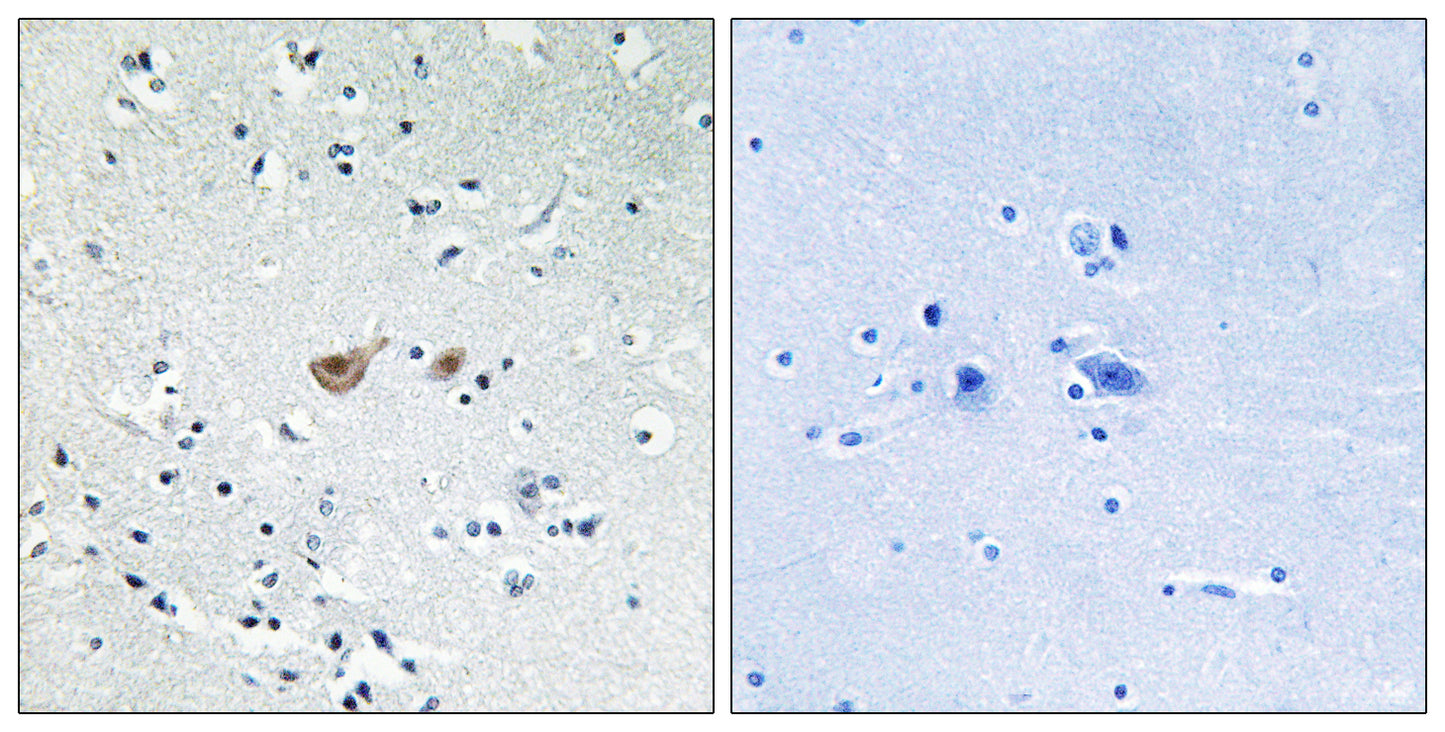 FoxO1 Rabbit Polyclonal Antibody