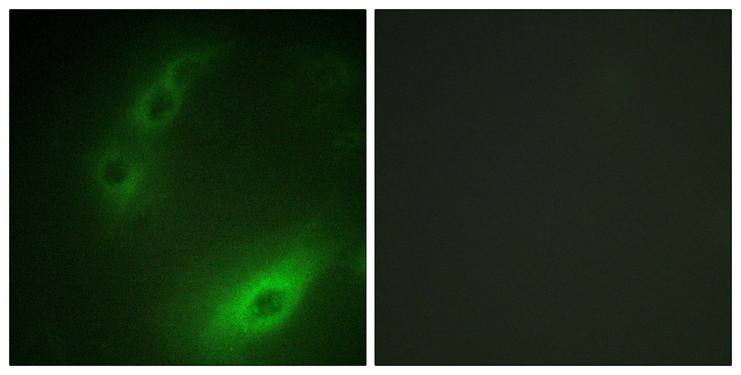 FoxO1A Rabbit Polyclonal Antibody