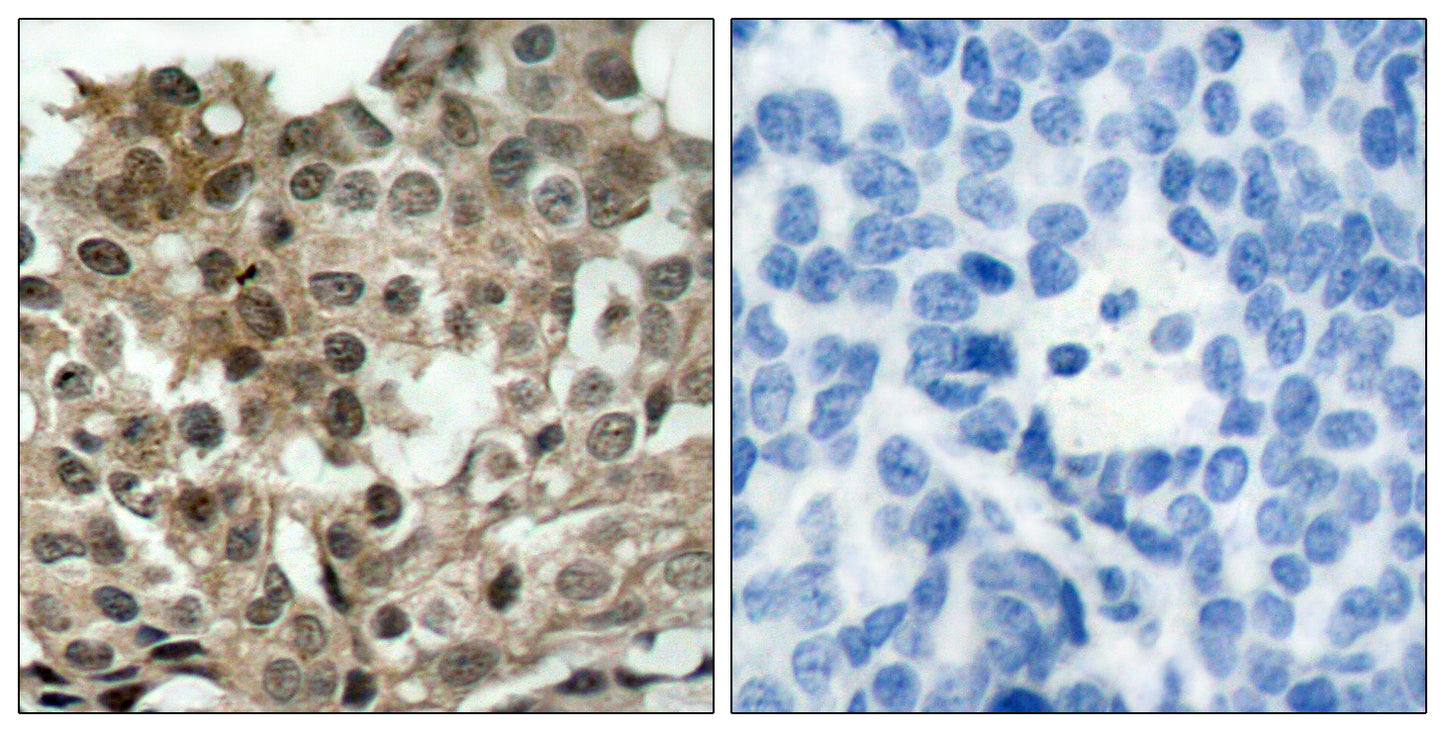 FoxO3A Rabbit Polyclonal Antibody