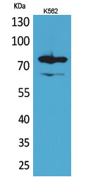 FOXP1 Rabbit Polyclonal Antibody