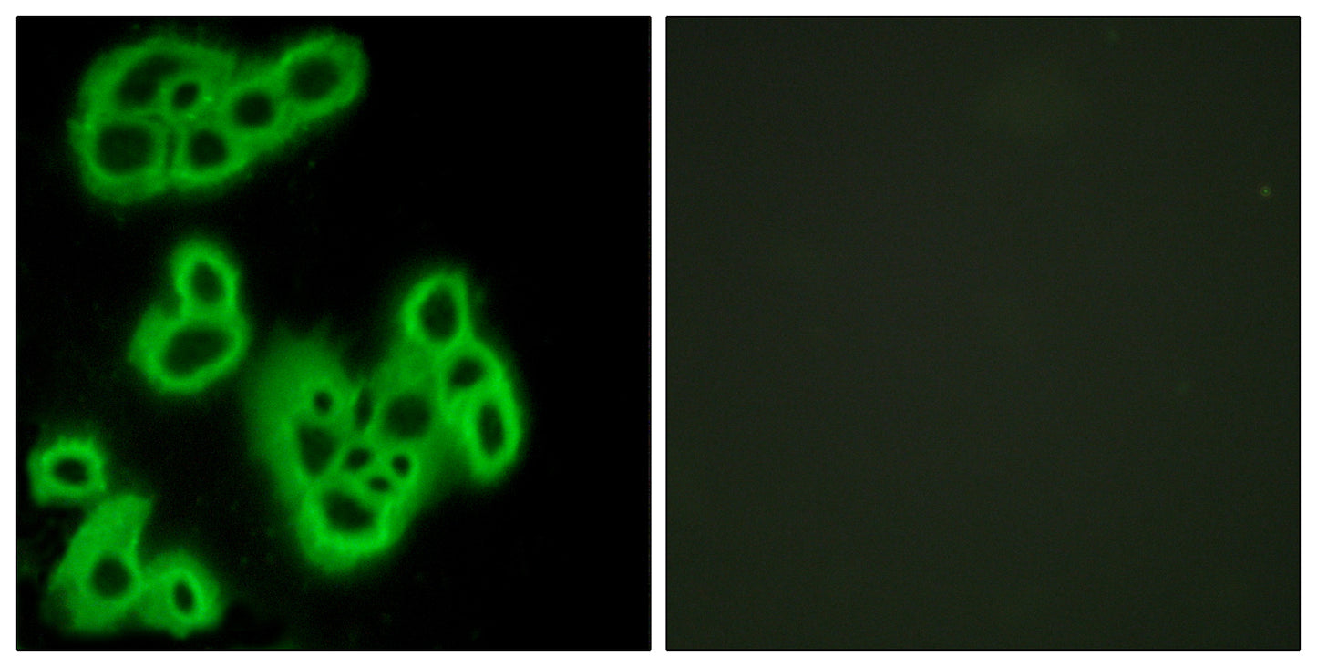FPR1 Rabbit Polyclonal Antibody