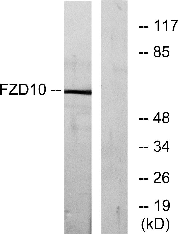 Frizzled-10 Rabbit Polyclonal Antibody