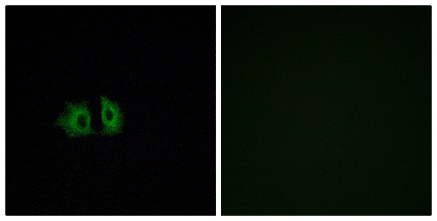 Frizzled-5 Rabbit Polyclonal Antibody