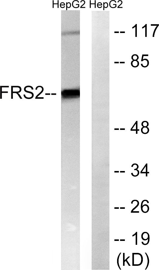FRS2 Rabbit Polyclonal Antibody