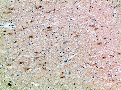 FSHβ Rabbit Polyclonal Antibody