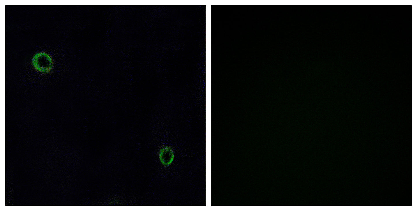 Fusin Rabbit Polyclonal Antibody