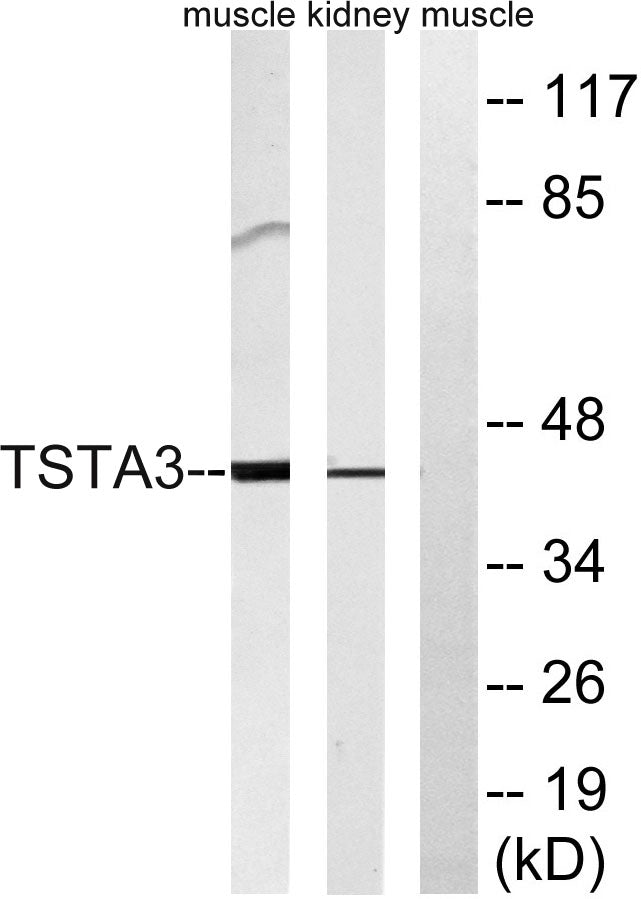 FX Rabbit Polyclonal Antibody