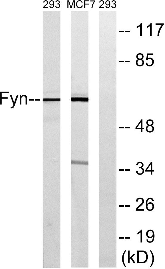 Fyn Rabbit Polyclonal Antibody