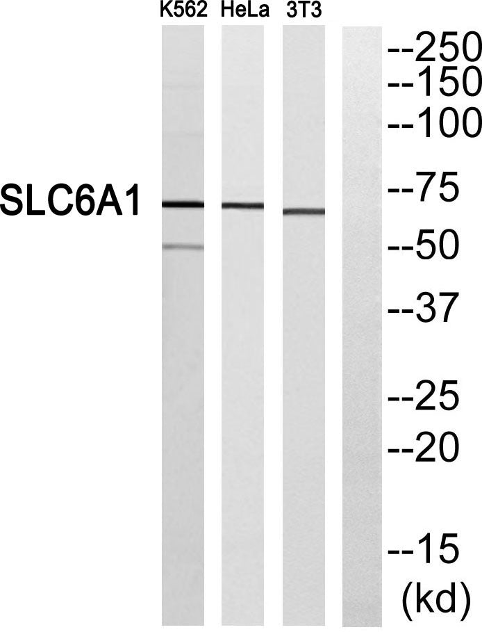 GABA T-1 Rabbit Polyclonal Antibody