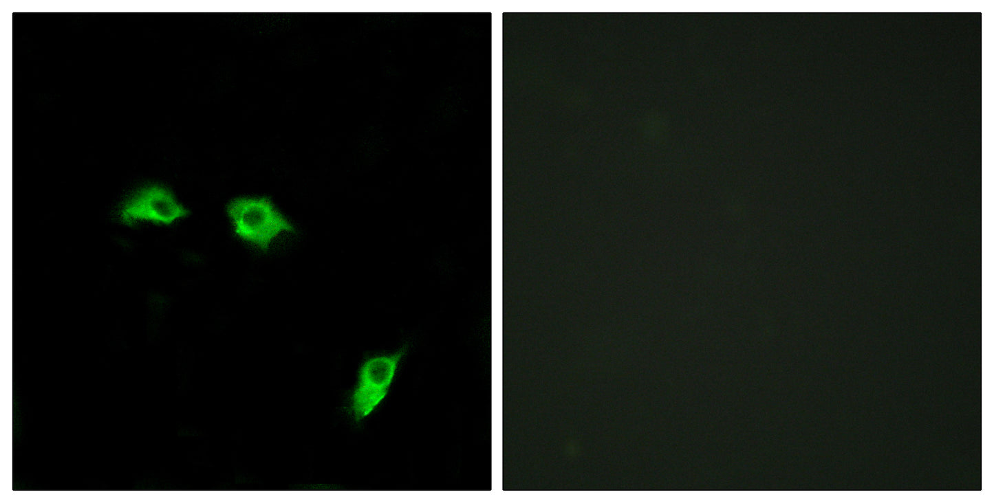 GABAB R1 Rabbit Polyclonal Antibody
