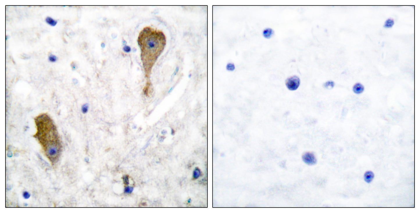 GAD67 Rabbit Polyclonal Antibody