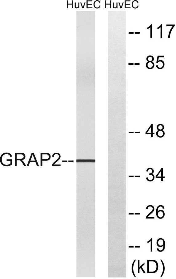 Gads Rabbit Polyclonal Antibody