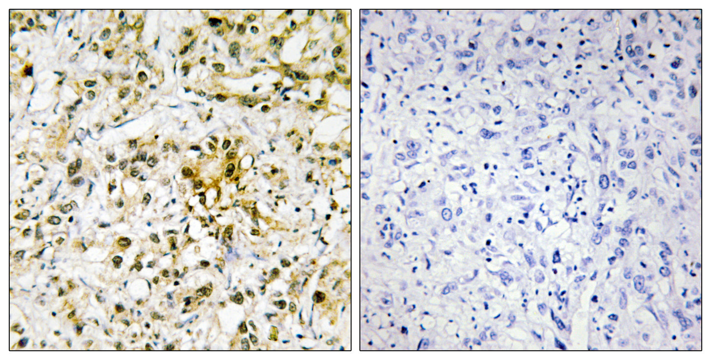 Galectin-4 Rabbit Polyclonal Antibody