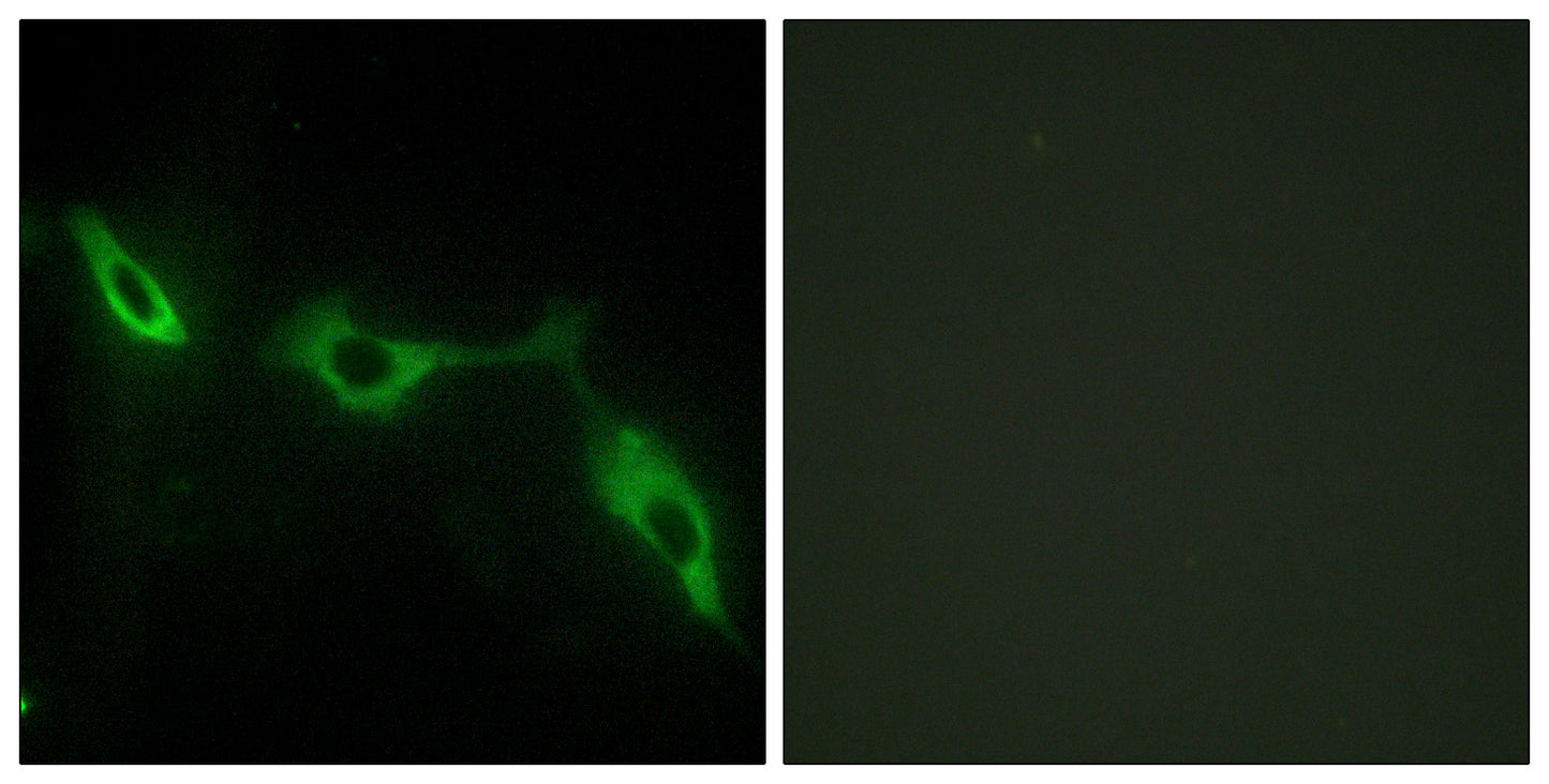 Galectin-9 Rabbit Polyclonal Antibody