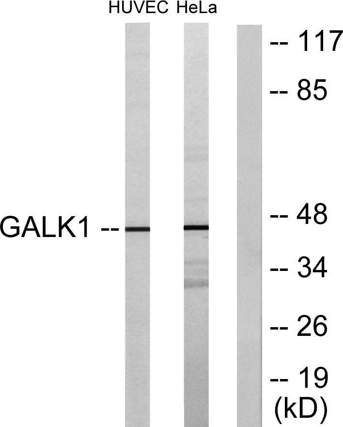 GALK1 Rabbit Polyclonal Antibody