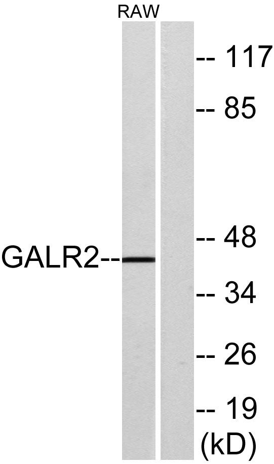 GALR2 Rabbit Polyclonal Antibody