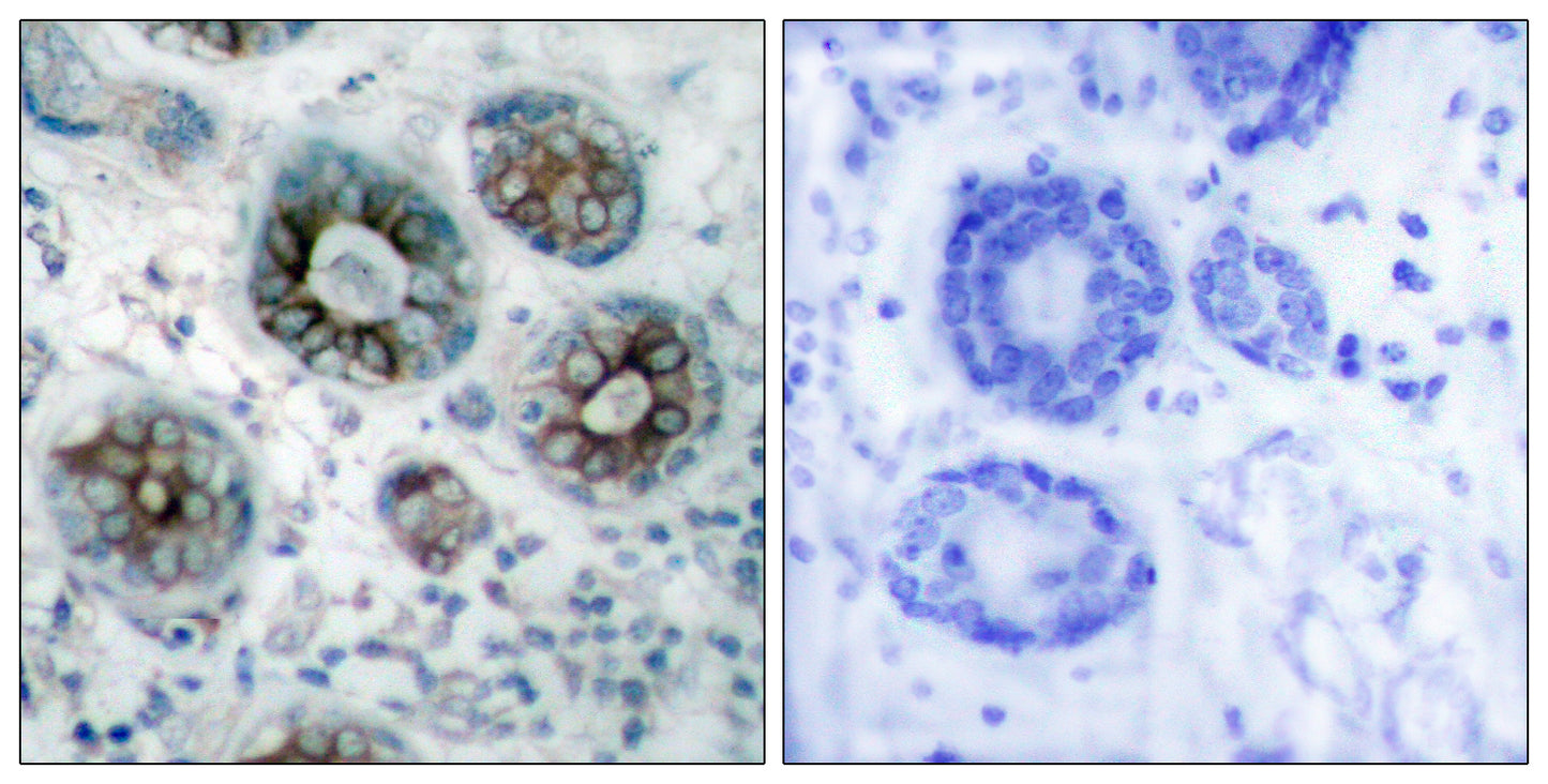 GAP-43 Rabbit Polyclonal Antibody