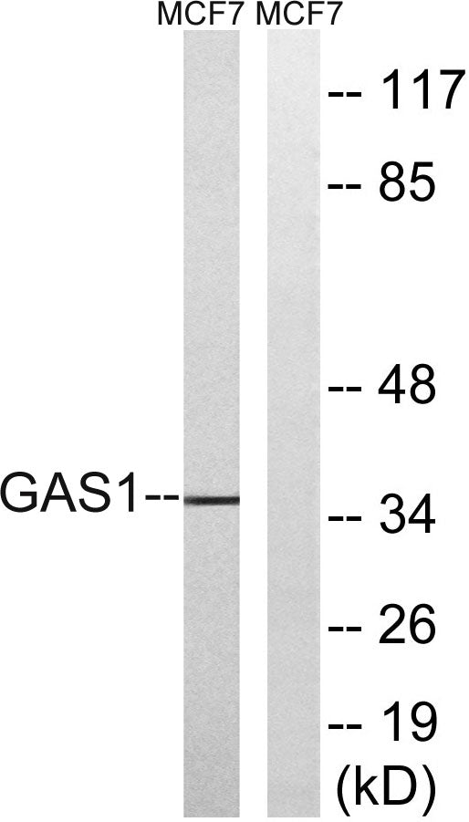 Gas1 Rabbit Polyclonal Antibody