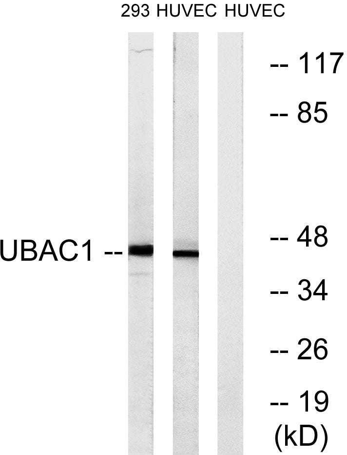 GBDR1 Rabbit Polyclonal Antibody
