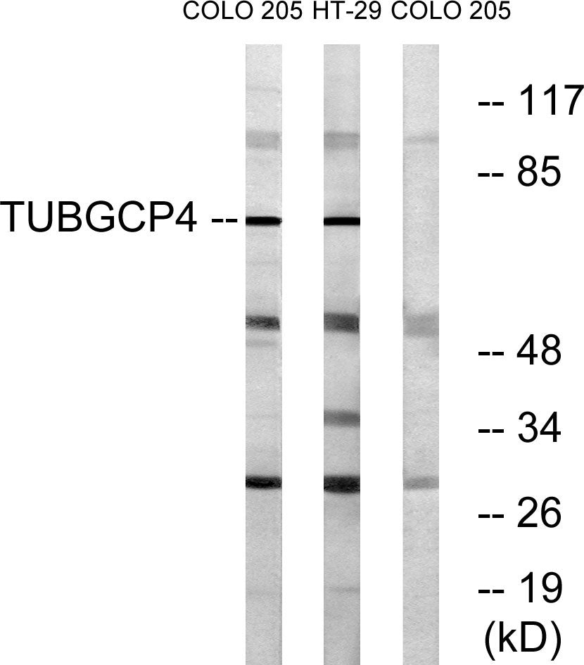 GCP4 Rabbit Polyclonal Antibody