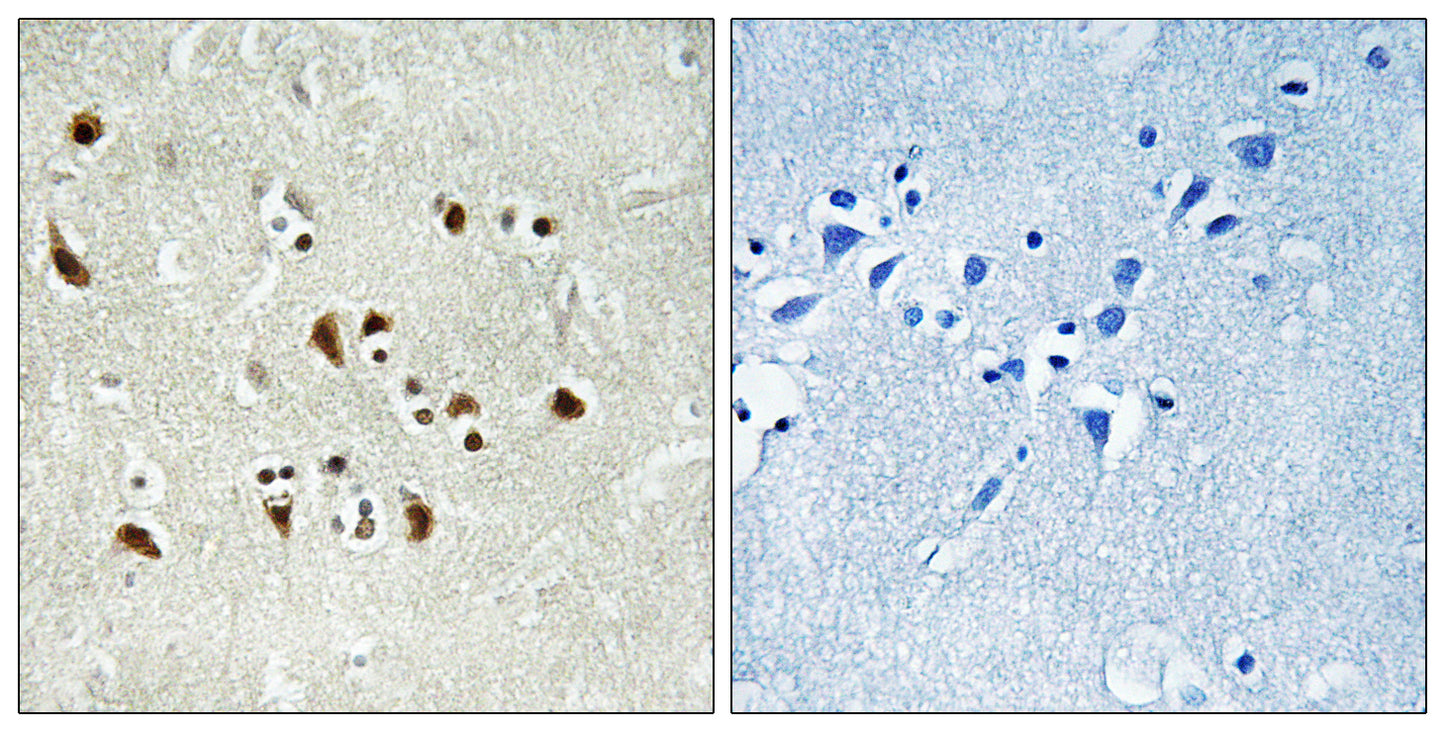 GCP6 Rabbit Polyclonal Antibody