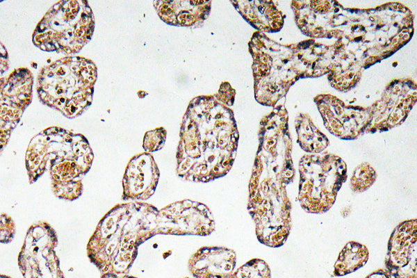 GCSm-γ Rabbit Polyclonal Antibody