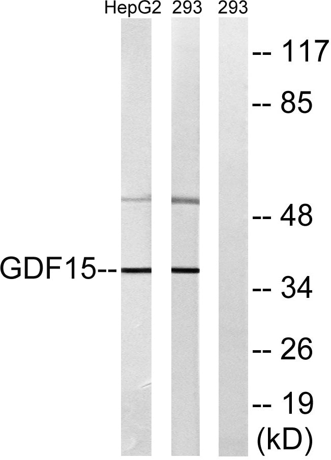 GDF-15 Rabbit Polyclonal Antibody