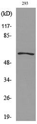 GDF-5 Rabbit Polyclonal Antibody