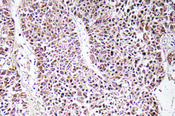 GDF-9 Rabbit Polyclonal Antibody
