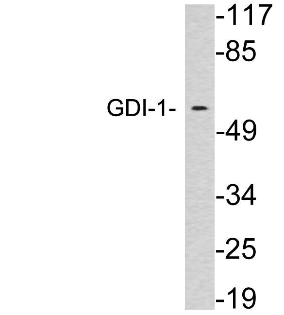 GDI-1 Rabbit Polyclonal Antibody