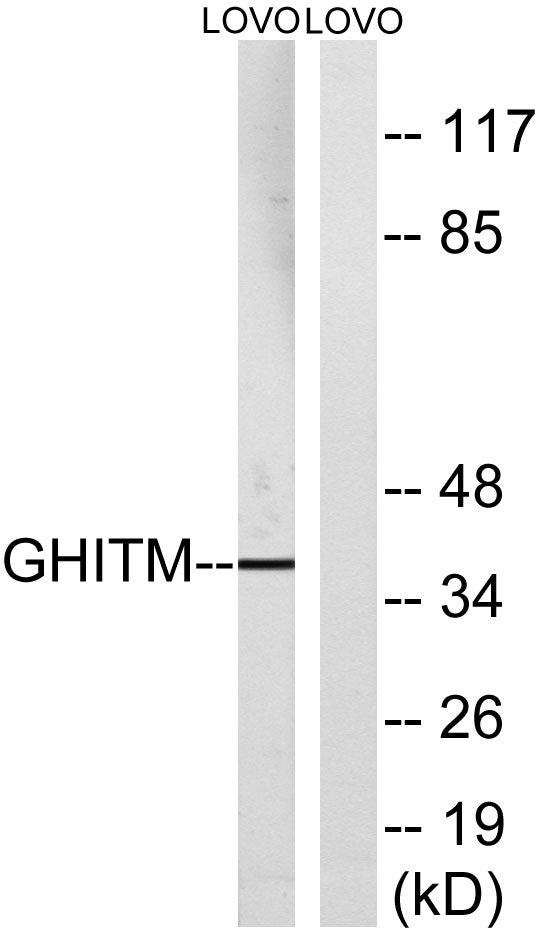 GHITM Rabbit Polyclonal Antibody