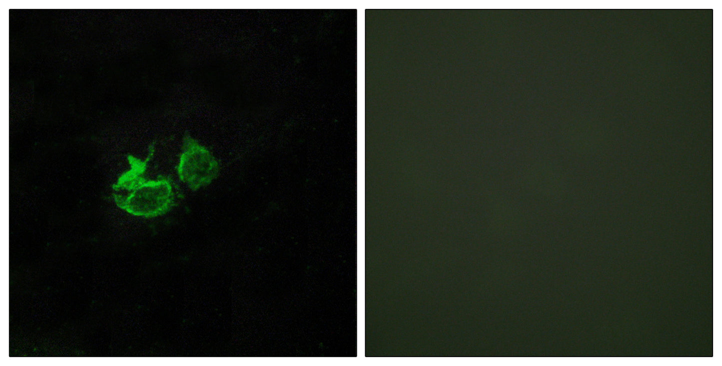 GHRH-R Rabbit Polyclonal Antibody