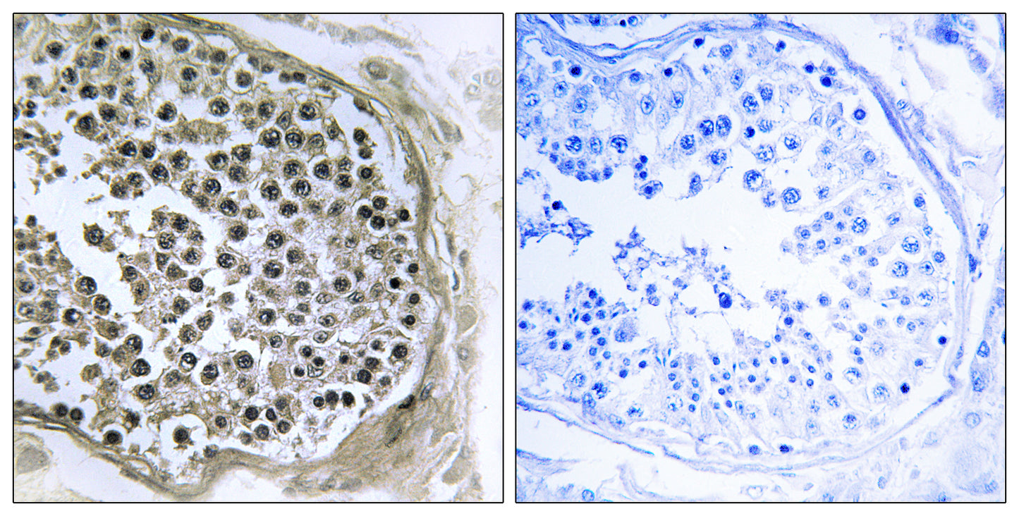 GIDRP88 Rabbit Polyclonal Antibody