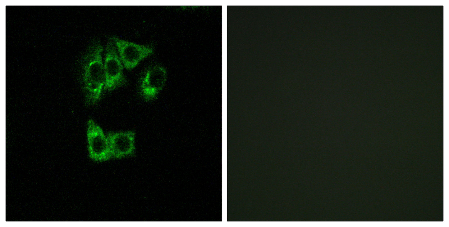 GIMAP2 Rabbit Polyclonal Antibody