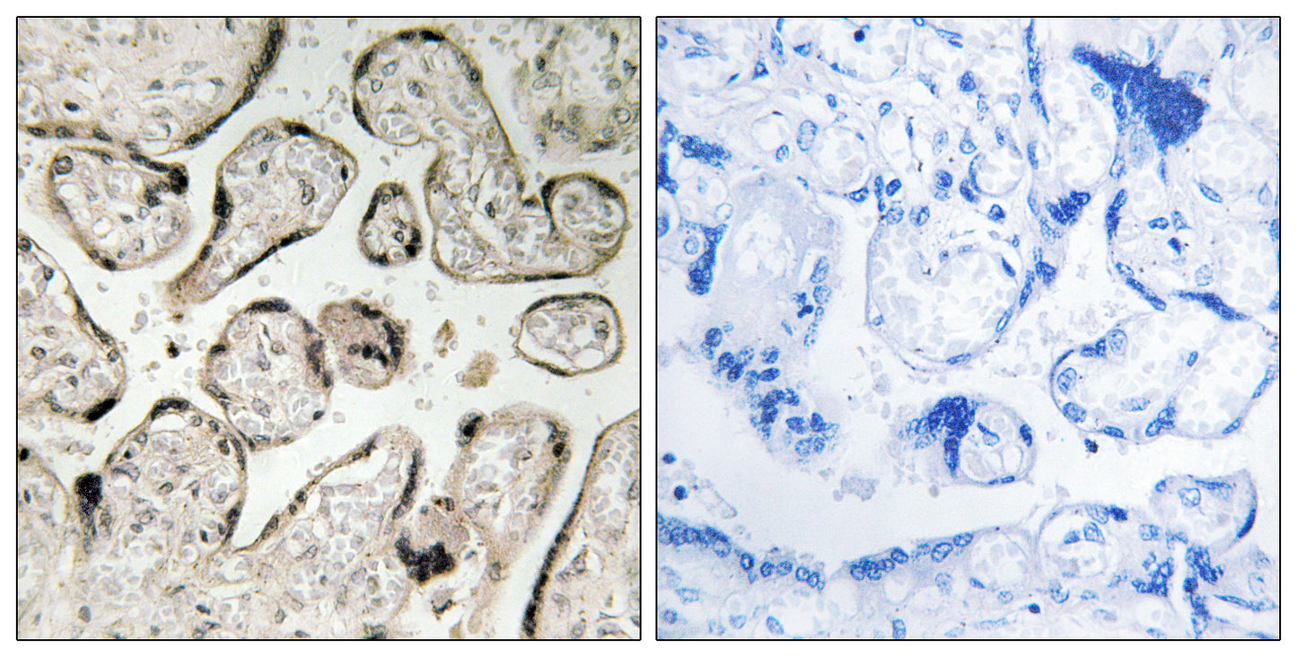 GIMAP5 Rabbit Polyclonal Antibody