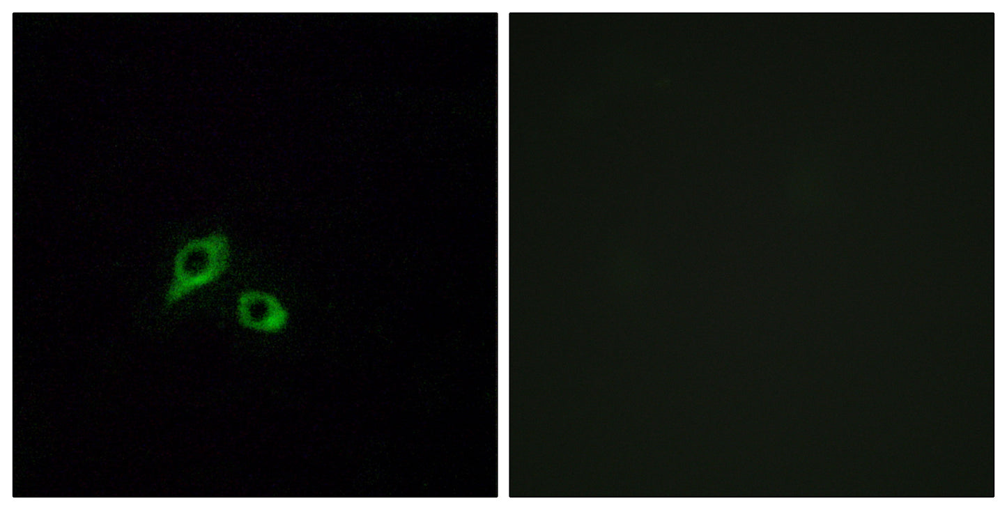 GIPR Rabbit Polyclonal Antibody
