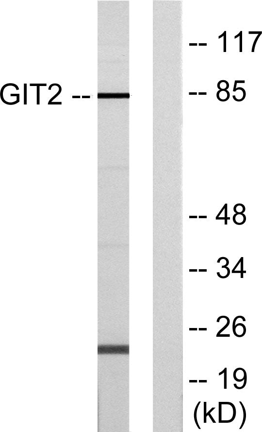 GIT2 Rabbit Polyclonal Antibody