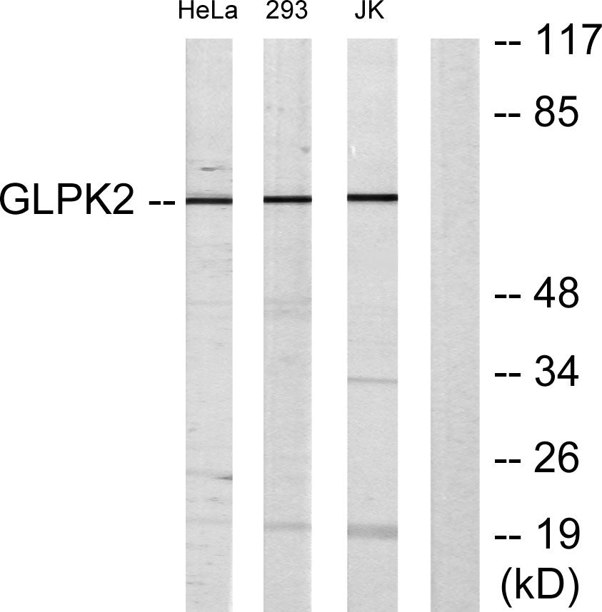 GK2 Rabbit Polyclonal Antibody