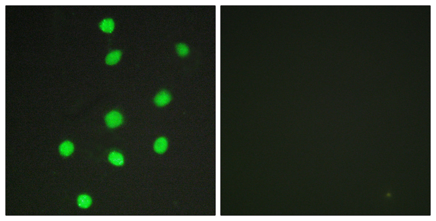 GLI-3 Rabbit Polyclonal Antibody
