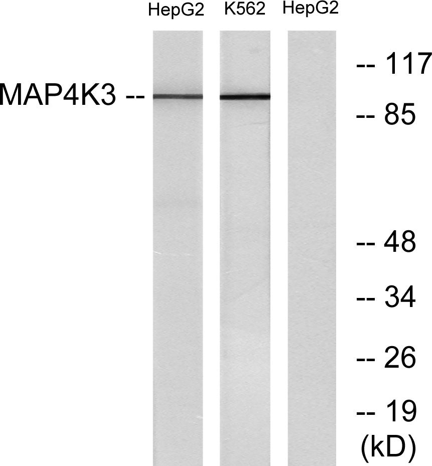 GLK Rabbit Polyclonal Antibody