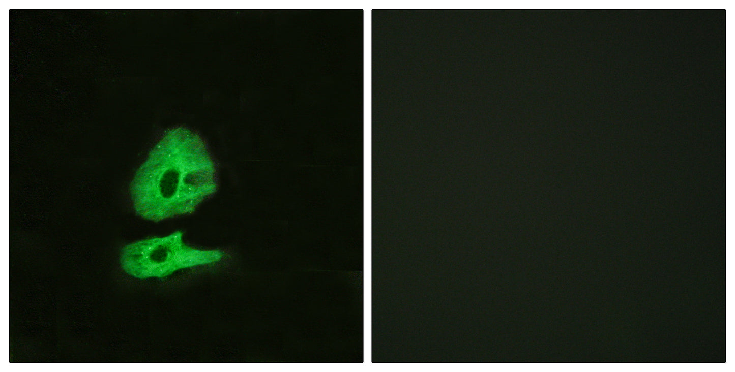 Glucagon Receptor Rabbit Polyclonal Antibody