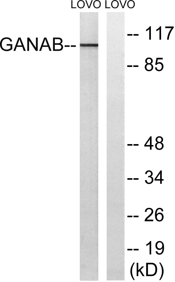 Glucosidase IIα Rabbit Polyclonal Antibody