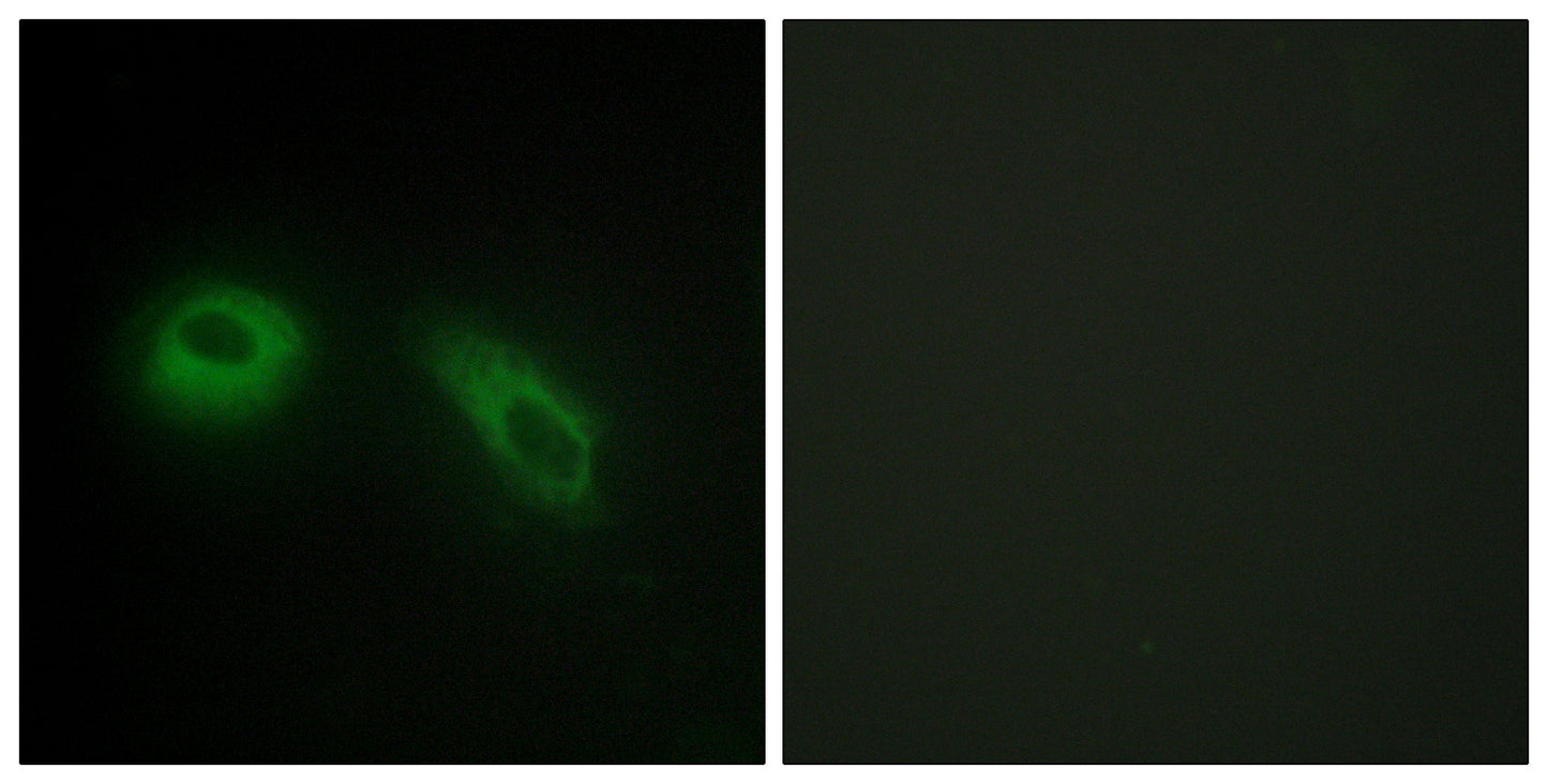 Glucosidase IIβ Rabbit Polyclonal Antibody