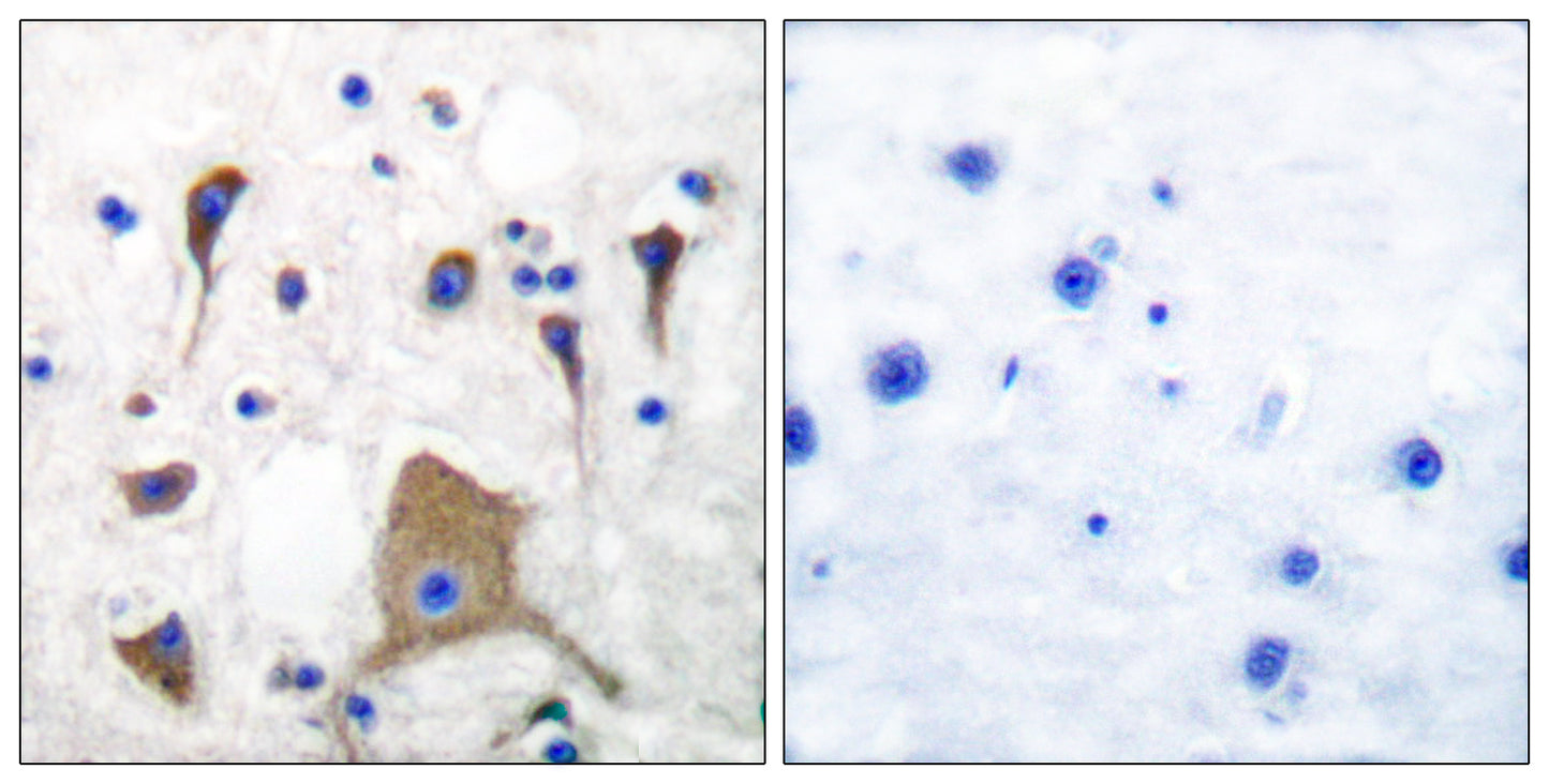GluR-5 Rabbit Polyclonal Antibody